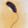 Холера бактериясының ЭМРТ-сы